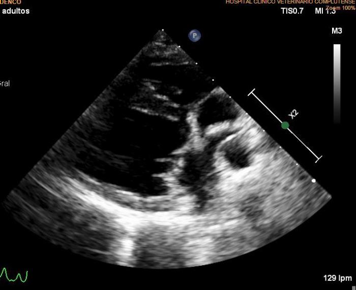 Figura 7A-D. Figura ecocardiografía tres meses después del tratamiento con melarsomina sódica (Servicio de Cardiología del HCVC). (A) Corte longitudinal paraesternal derecho de 4 cámaras similar a la imagen 1a, en la que se pone de manifiesto la dilatación de la arteria pulmonar derecha, no se observan imágenes hiperecogénicas lineales dobles compatibles con vermes adultos. (B) Modo M obtenido a partir de un corte transversal paraesternal derecho a nivel de los músculos papilares. En este momento se observa una normalización en las dimensiones y funcionalidad ventricular izquierda. (C) Doppler pulsado obtenido a través de la válvula pulmonar evidenciando un flujo sanguíneo asimétrico con tiempo de aceleración disminuido. (D) Corte transversal paraesternal derecho a nivel del tronco pulmonar. Se observan algunas imágenes hiperecogénicas lineales dobles (signo de igual) compatibles con vermes adultos (flecha). (*) Siglas de los informes ecocardiográficos: EDVI: end diastolic ventricular index; DVIn: dimensión ventricular izquierda en diástole normalizada; AO: aorta; AI: atrio izquierdo. FA: fracción de acortamiento.