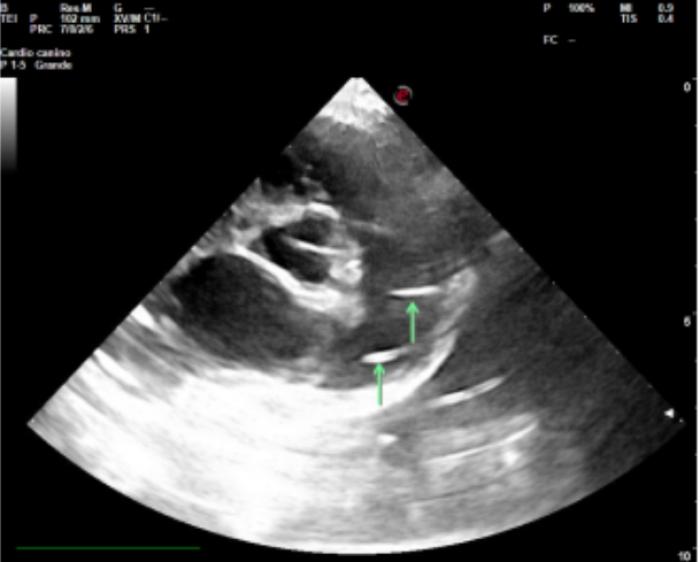 Figura 3. Ecocardiografía en el Hospital Universitario de la UAX (imagen cortesía: de Alejandro Casasús).