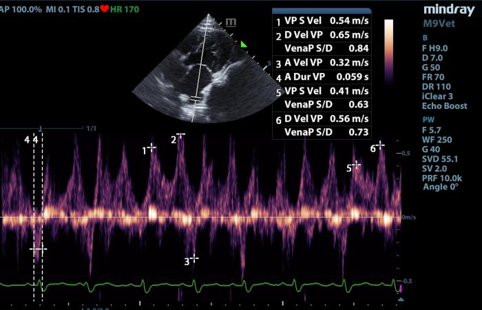 Figura 12. Flujo vena pulmonar pseudonormal, diastólico dominante en un gato con CMH.