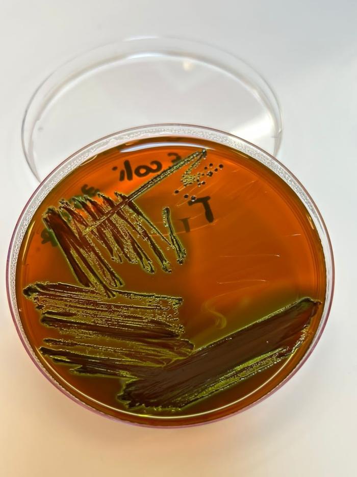 Figura 2. Colonias negruzcas (con cierto brillo verde metálico) de E. coli en agar Levine. Este es un medio de cultivo selectivo para enterobacterias que inhibe el crecimiento de grampositivos (imagen cortesía de la Dra. Liliana Fernández Canigia).