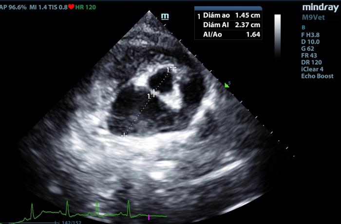 Figura 1. Método sueco de medición del diámetro del atrio izquierdo respecto al diámetro de aorta.