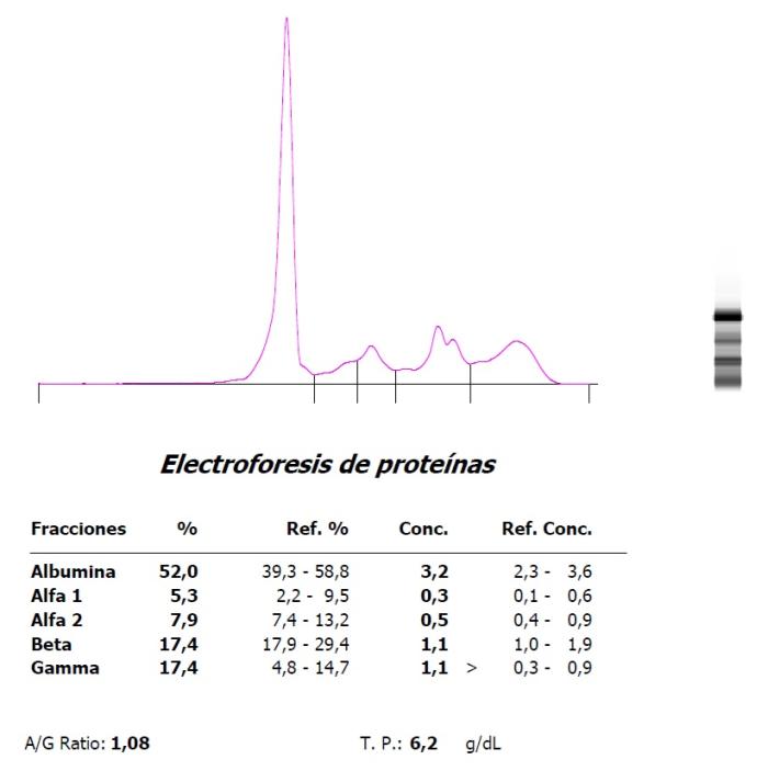 Figura 4. Hipergammaglobulinemia policlonal en un hurón (Mustela putorius furo) con neumonía.