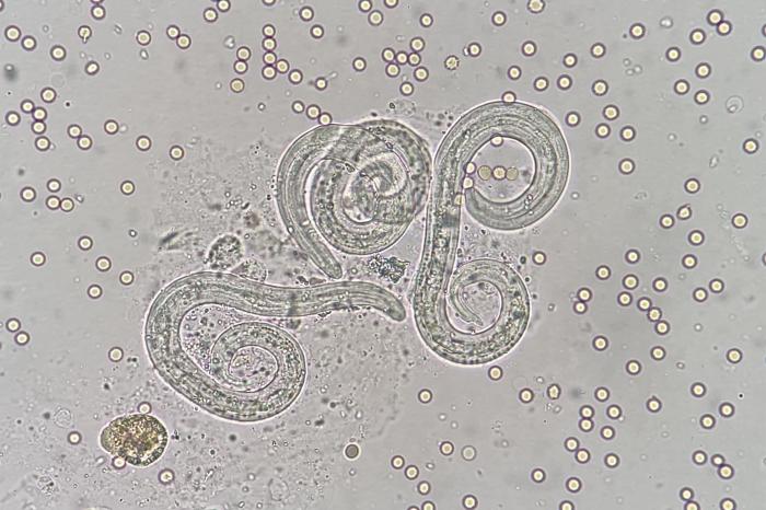 Figura 23. Muestra en fresco del lavado broncoalveolar del caso anterior. La preparación en húmedo permite un mejor detalle de la morfología larvaria. Las larvas de Angiostrongylus vasorum se caracterizan por su curvatura y una espina dorsal en el extremo distal.