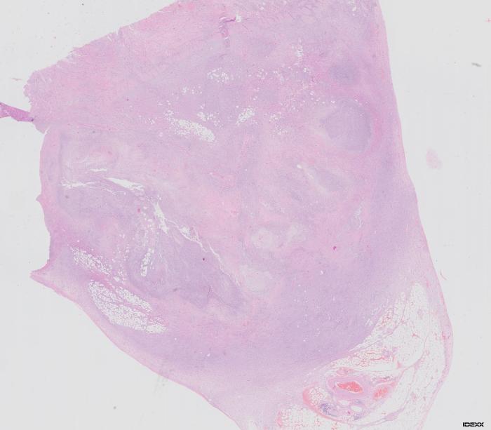 Figura 3A-D. Histopatología intestinal que evidencia linfangitis lipogranulomatosa focal grave, con infiltrado inflamatorio mixto, hemorragia, fibroplasia leve y dilatación de vasos linfáticos con macrófagos espumosos y células gigantes multinucleadas.