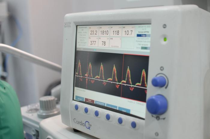 Figura 1. El monitor de gasto cardiaco cardioQ permite identificar cambios hemodinámicos con gran sensibilidad y rapidez de forma poco invasiva.
