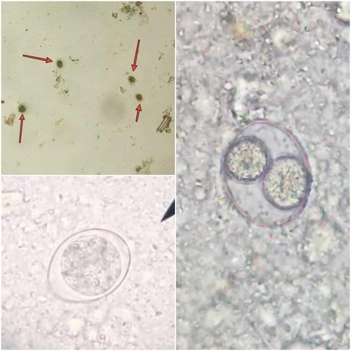 Figura 13. Isospora en heces de un cachorro de 2 meses. Fotos realizadas en Clínica Veterinaria Viñas Viejas.