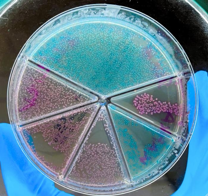 Figura 4. Flexicult® positivo a E. faecalis (colonias azules claro y cocos Gram-positivos en citología) e infección por E. coli (colonias rosas que se demostraron como bacilos Gram-negativos en la citología). La E. coli mostraba resistencia a ampicilina, oxacilina, enrofloxacino y T/S. El E. faecalis se puede ver su crecimiento en la sección de la amoxicilina/clav y en la sección superior donde se estima la cantidad de unidades formadoras de colonia.