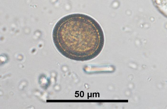 Figura 1. Huevo de cestodo de Taeniidae en una muestra fecal canina (fuente: LABOKLIN).