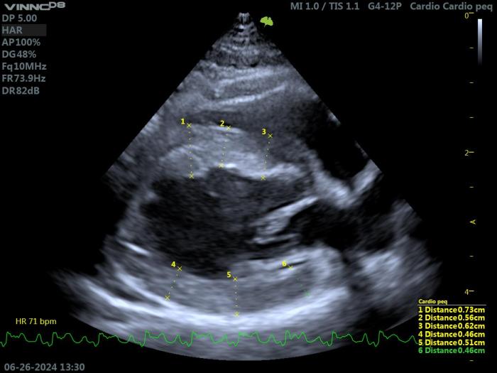 Figura 4. Ecocardiografía 2D en un gato con HCM. Proyección paraesternal derecha de eje largo 4 cámaras. Valoración del grosor del septo y de la pared libre (grosor máximo obtenido 7.3 mm).