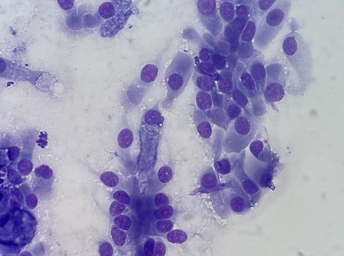 Figura 15. Detalle de citología obtenida mediante cepillado en la que se observa epitelio columnar y cuboidal ciliado.