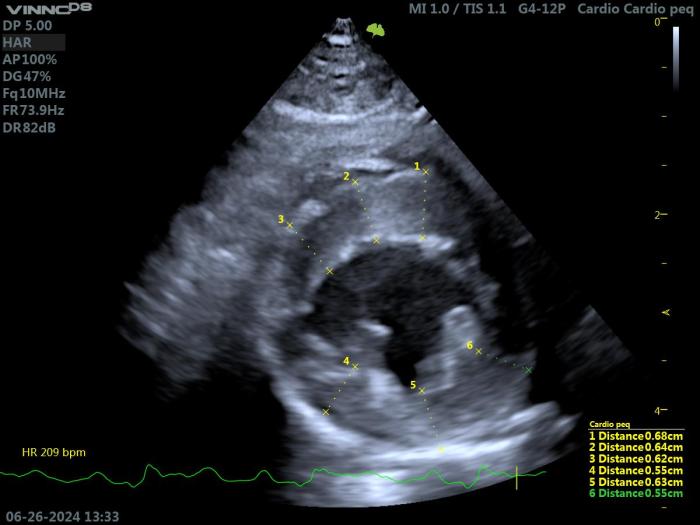 Figura 5. Ecocardiografía 2D en un gato con HCM. Proyección paraesternal derecha de eje corto a nivel del VI. Valoración del grosor del septo y de la pared libre (grosor máximo obtenido 6.8 mm).