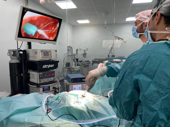 Figura 5. Imagen intraoperatoria durante la toracoscopia subxifoidea y la creación de un espacio de trabajo mediante dos portales intercostales para la realización de una pericardiectomía, pericardioscopia y escisión de la masa cardiaca.