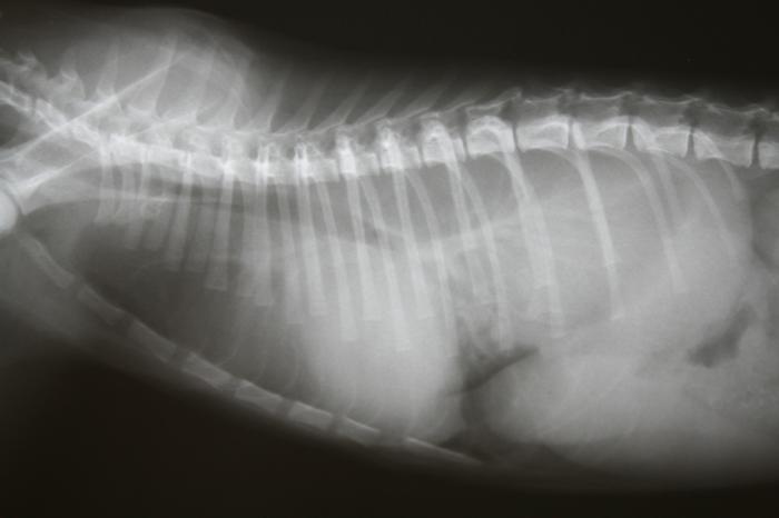 Figura 2. Radiografía de tórax y abdominal donde se aprecia presencia de derrame pleural y ascitis.
