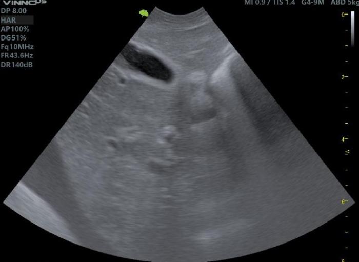 Figura 2. (A) Ecografía abdominal donde se observa hepatomegalia leve y ascitis. (B) Ecografía abdominal donde se observa yeyuno y ascitis (imágenes cortesía de la Dra. Vet. Marisol Anabel Pepe M.P. 12.380).