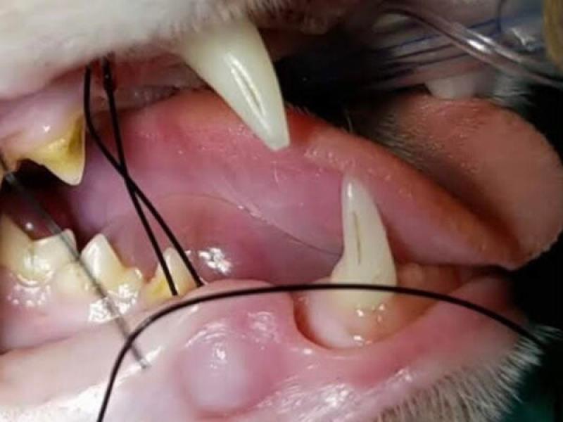 Figura 1. (A) Se introduce la aguja con nylon desde la piel del mentón saliendo a craneal del frenillo labial siguiendo luego por el labio superior desde la mucosa vestibular hacia la piel.