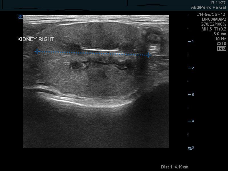 Figura 1. Imagen ecográfica de riñón derecho durante el proceso diagnóstico.