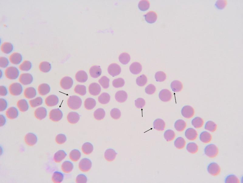 Figura 1. Mycoplasma haemofelis infectando eritrocitos. Las flechas indican la localización de este patógeno en la superficie de los eritrocitos, caracterizado por su coloración basófila tras tinción con panóptico rápido (100X). (Imagen cedida por la Dr. Séverine Tasker, Bristol Veterinary School, University of Bristol, Reino Unido).