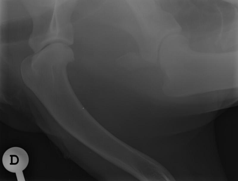 Figura 1. Radiografía lateral de la articulación escapulohumeral derecha donde se aprecia osteoartritis moderada de la articulación escapulo-humeral y signos de calcificación en la zona de inserción del bíceps braquial y músculo supraespinoso.