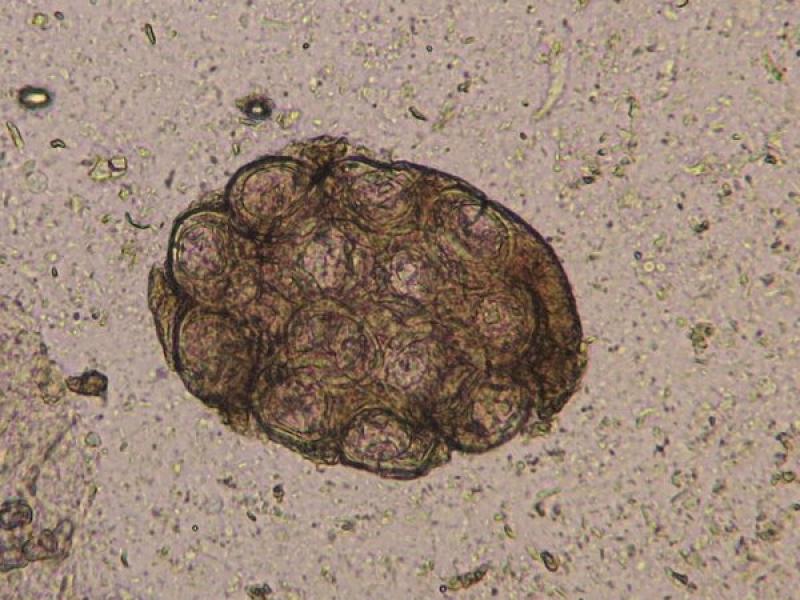 Figura 10. Cápsula ovígera de Dypilidium caninum (10x).