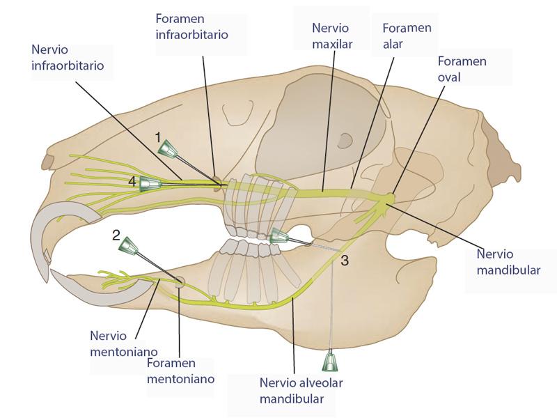 Figura 11. Diagrama para bloqueos nervios craneales en conejo. 1,4: abordaje bloqueo nervio infraorbitario. 2: abordaje bloqueo nervio mentoniano. 3: abordaje bloqueo nervio alveolar mandibular. De Popesko modificado(44).