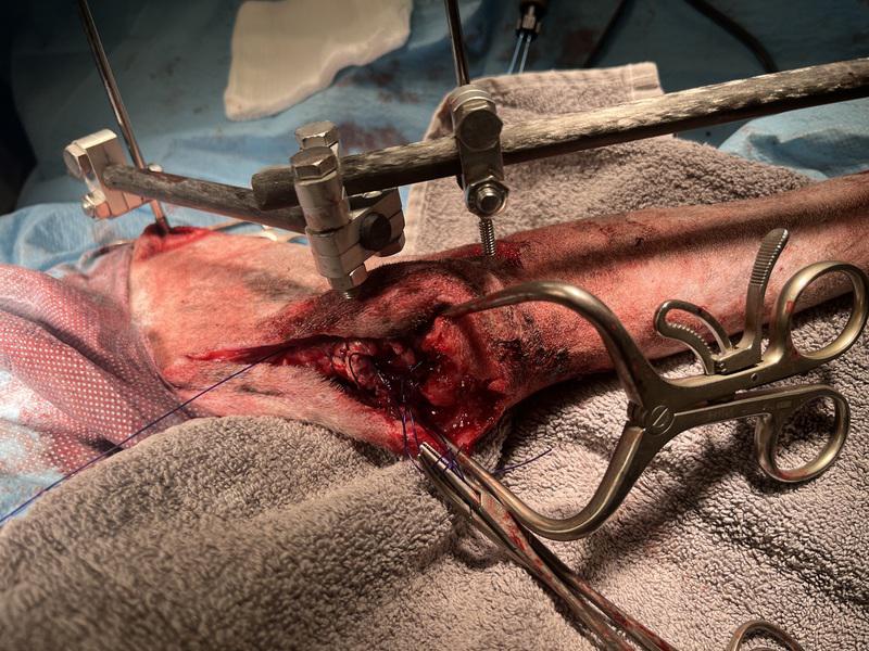 Figura 11. imagen intraoperatoria. Antes de proceder a anudar las suturas, se colocó un fijador externo transarticular con el codo en hiperextensión.