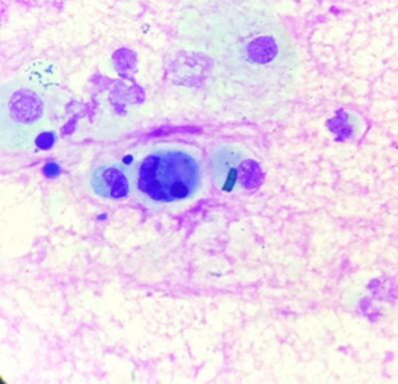 Figura 11. Imagen microscópica (x100). Imagen en la que se puede apreciar un macrófago con material vegetal fagocitado en un lavado traqueal de caballo.