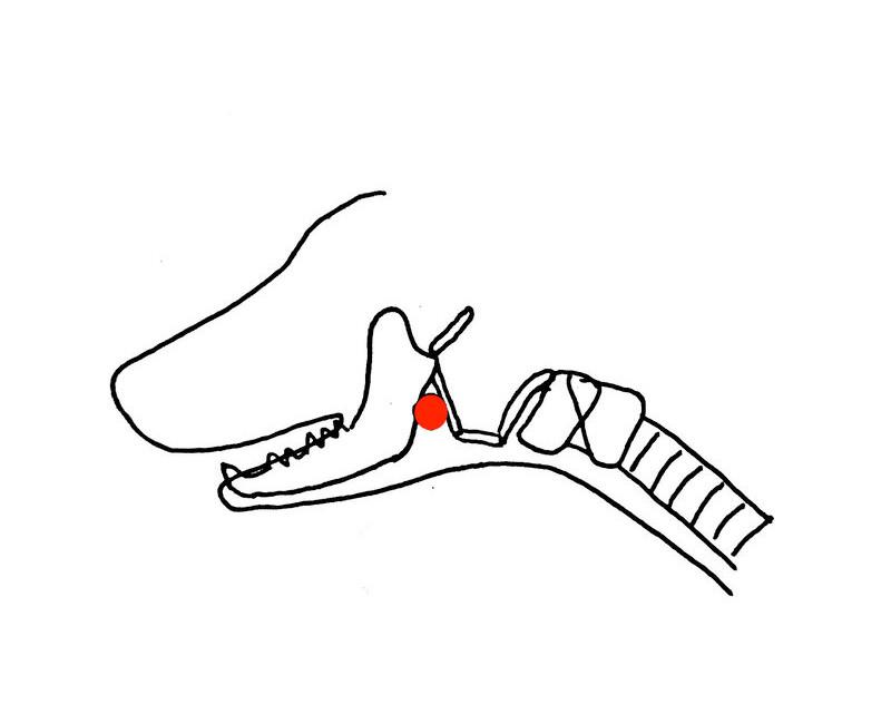 Figura 12. Círculo rojo: zona de inserción del tubo endotraqueal para la intubación por faringotomía.