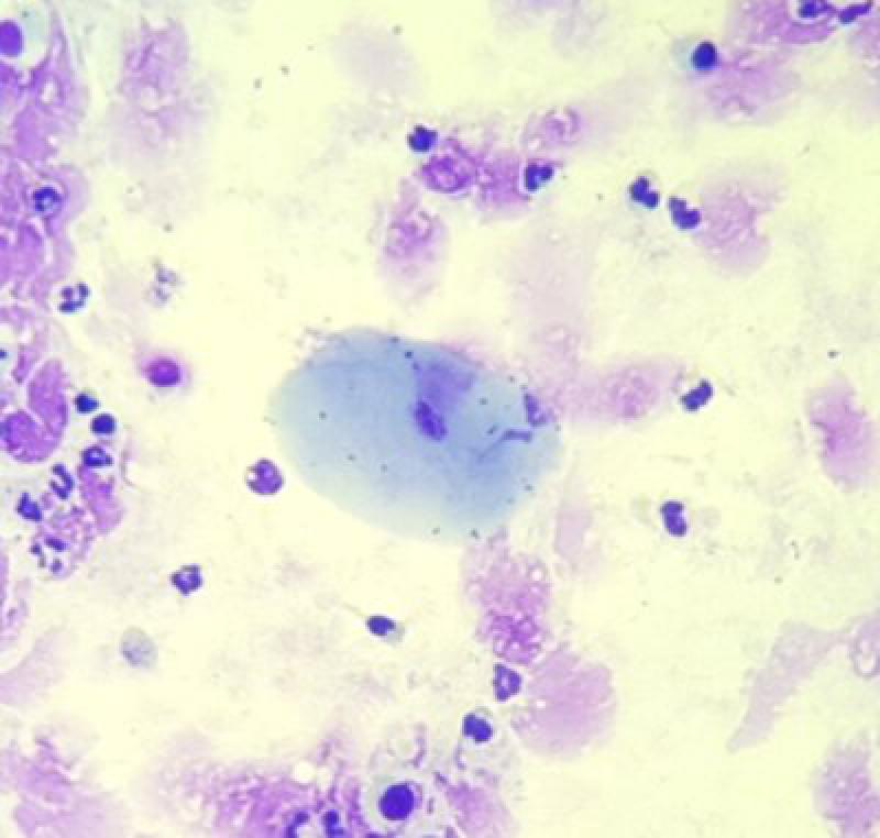 Figura 12. Imagen microscópica (x40). Imagen de una célula epitelial escamosa con bacterias en su superficie en un lavado broncoalveolar de caballo.