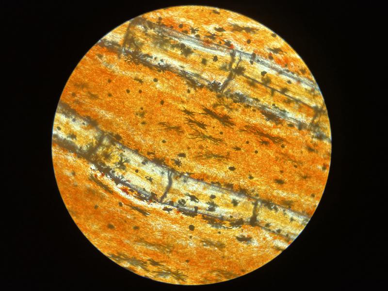 Figura 13. Imagen microscópica normal de una biopsia de aleta en la que se evidencia la presencia de multitud de cromatóforos, así como de radios espinosos 400x.
