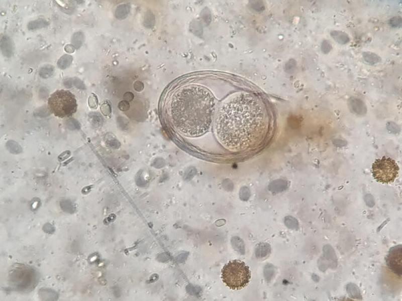 Figura 14. Huevo de Toxascaris leonina embrionado (40x).