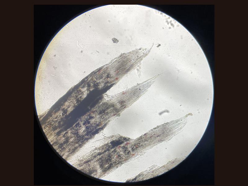 Figura 14. Imagen microscópica del borde de una biopsia de aletas en la que se aprecia la punta de los radios expuesta y falta del tejido conectivo 400x