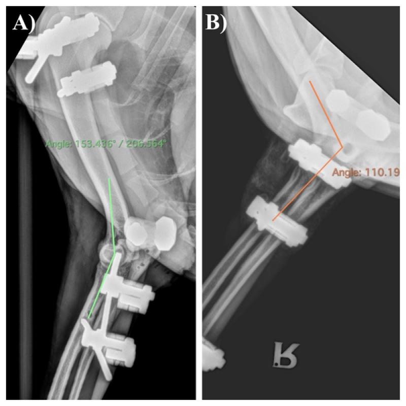 Figura 15. radiografías de seguimiento a las 4 semanas de la cirugía (proyección lateral). Se puede observar el ángulo de extensión del codo en el postoperatorio inmediato (A) en comparación con las modificaciones realizadas a las 4 semanas (B).