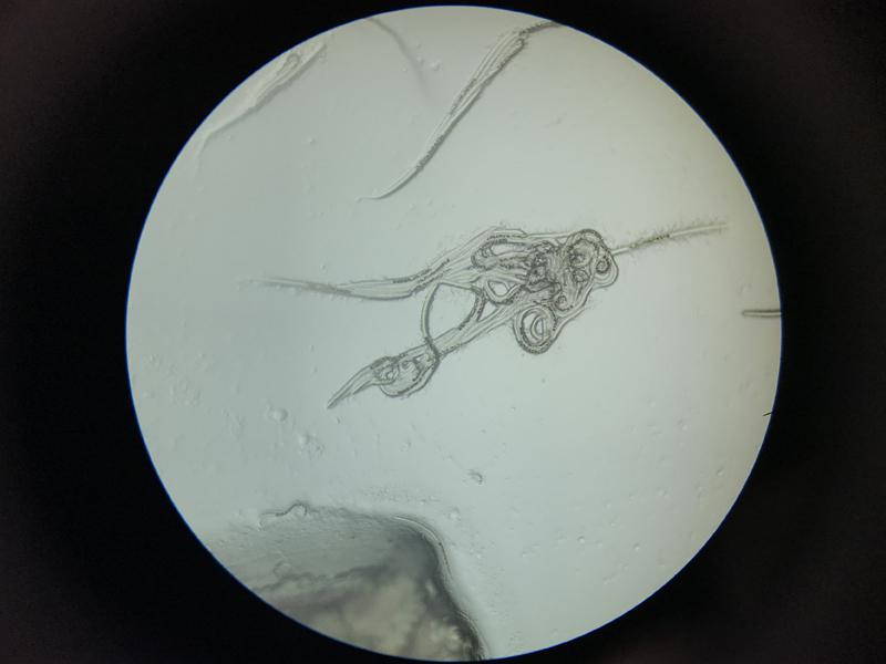 Figura 16. Larvas de nematodos en muestra de heces de Paracanturus hepatus 100x