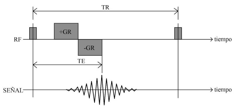 Figura 16. Representación básica de una secuencia GRE.