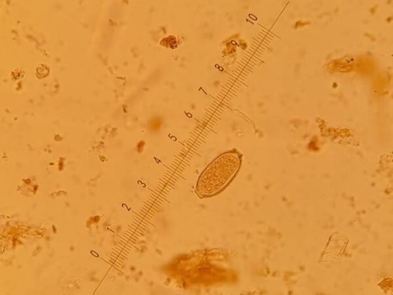Figura 18. Huevo de Capillaria aerophila (40x).