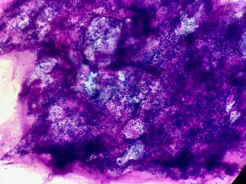 Figura 18. Imagen de biofilm al microscopio óptico, observe la abundancia de elementos bacterianos dispuestos en el interior de una matriz de color azulado.