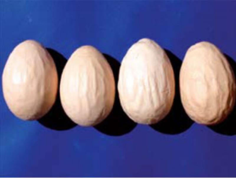 Figura 18. Síndrome de caída de la puesta, huevos pigmentados o deformados, o huevos con cáscaras débiles.