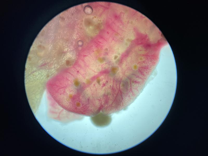 Figura 18b. Lóbulo hepático de Paracheirodon innesi con una congestión marcada en el que se aprecia la presencia de varias lesiones granulomatosas de color marrón ambarino 40x