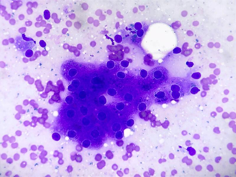 Figura 1A. Células encontradas de forma normal en la citología hepática.Hepatocitos con morfología normal.