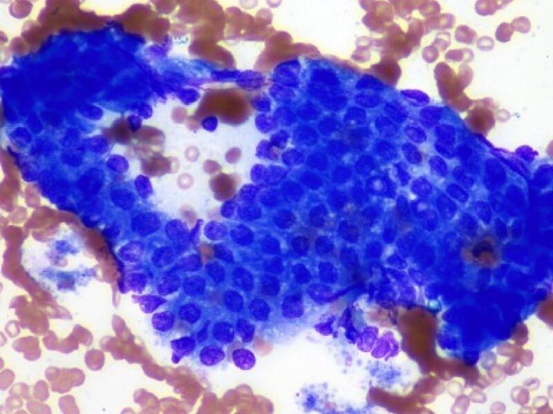 Figura 1B. Grupo de células de epitelio biliar.