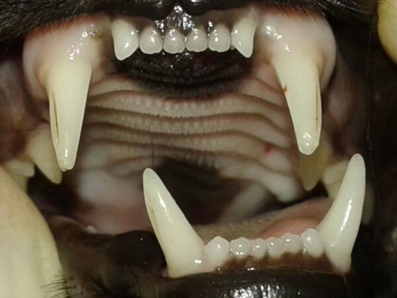 Figura 2. (B) Desplazamiento mandibular marcado hacia el lado de la fractura con alteración evidente de la oclusión dental e imposibilidad de corrección mediante fiijacion de nylon debido a la gran inestabilidad fracturaria.