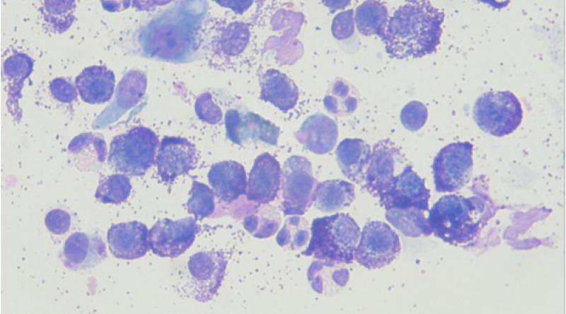 Figura 2. En la imagen se observan células redondas con el citoplasma repleto de gránulos basófilos, compatibles morfológicamente con mastocitos bien diferenciados y células con el núcleo segmentado y gránulos anaranjados-rosados, que se corresponden con eosinófilos.