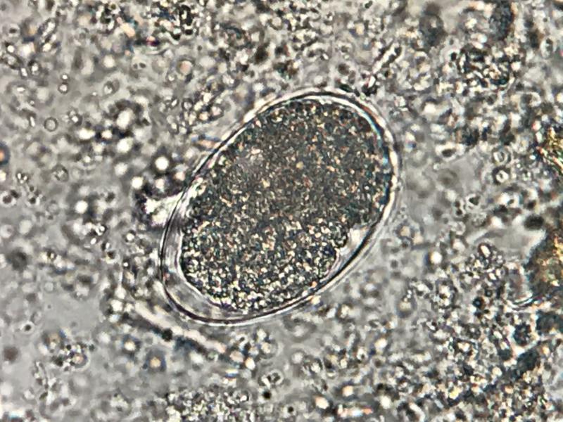 Figura 2. Huevo ancilostomido en sedimento Telemann modificado.
