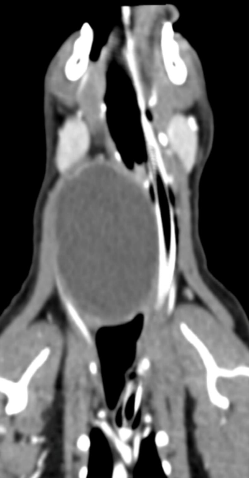 Figura 2. Imagen de TC de un paciente felino hipertiroideo con una masa de gran tamaño que desplaza el tubo endotraqueal.