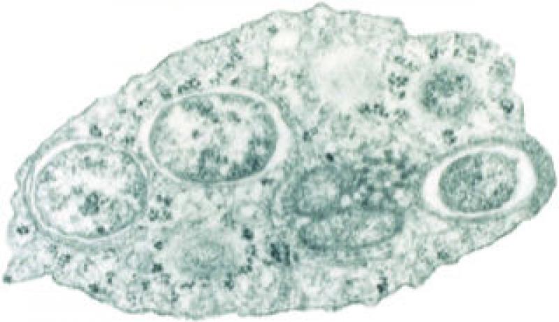Figura 2. Imagen obtenida mediante microscopía electrónica de transmisión de una bacteria Wolbachia dentro de una célula de insecto (Imagen cortesía de Scott O'Neill)