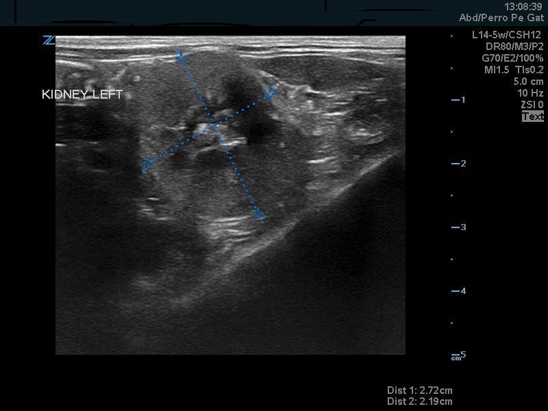Figura 2. Imágenes ecográficas de riñon izquierdo durante el proceso de diagnóstico.