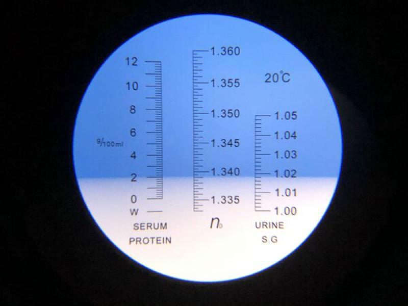 Figura 2: Medición con espectofotómetro de Goldberg.