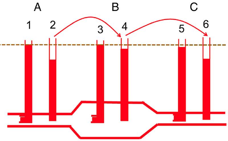 Figura 2. Mediciones de presión en un vaso sanguíneo con una región aneurismática. Las presiones medidas con catéteres orientados hacia el flujo (1, 3, 5) miden la energía elástica y cinética, mientras que los tubos con la abertura perpendicular al flujo sólo miden la presión lateral (2, 4, 6). Se supone que la pérdida de energía debida a la resistencia (línea discontinua) es mínima. En A, el tubo orientado hacia el flujo (1) muestra una presión mayor que el tubo que mide la presión lateral (2) porque incluye la energía cinética. En B, el diámetro del vaso es mayor y la velocidad del flujo es menor. La energía cinética se convierte en energía elástica y la diferencia entre los tubos 3 y 4 es mucho menor que entre 1 y 2. En C, el tubo vuelve a estrecharse, por lo que aumenta la energía cinética y disminuye la energía lateral, lo que aumenta de nuevo la diferencia entre 5 y 6. Adaptado de Magder, 2018.