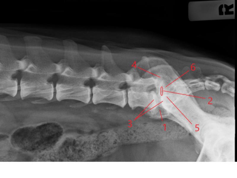 Figura 2. Radiografía de paciente con estenosis lumbosacra, con algunas de las características radiológicas más frecuentes remarcadas.