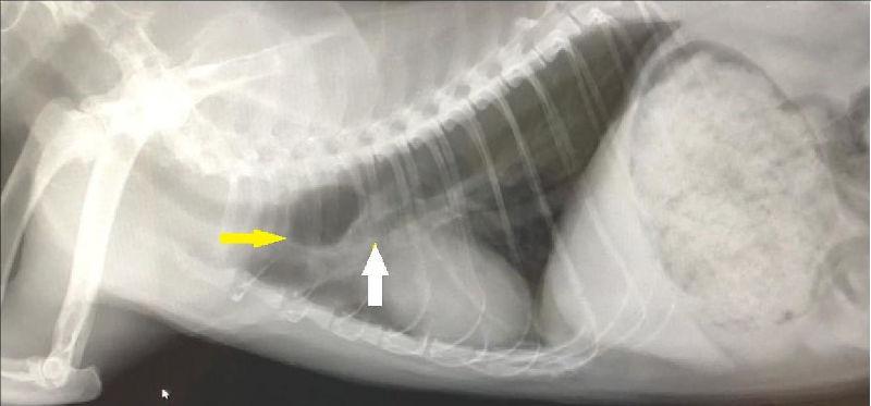 Figura 2. Radiografía torácica prequirúrgica. Se observa la formación de un pseudodivertívulo con la adventicia traqueal (flecha amarilla). Y una desviación ventral de la traque distal al defecto (flecha blanca).